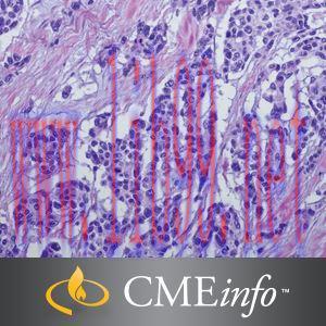 [AME]Soft Tissue Tumors – Masters of Pathology Series 2018 (CME Videos)