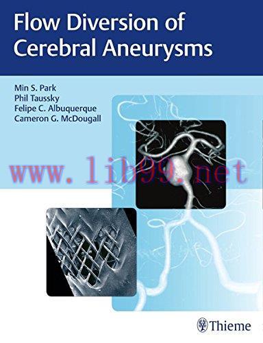 [AME]Flow Diversion of Cerebral Aneurysms (EPUB)