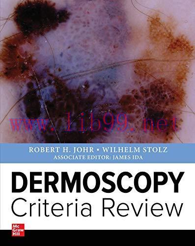 [AME]Dermoscopy Criteria Review (ORIGINAL PDF from_ Publisher)
