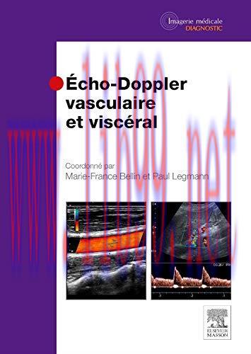 [AME]Echo-doppler Vasculaire Et Viscéral (French Edition) (Original PDF)