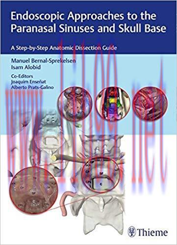 [PDF]Endoscopic Approaches to the Paranasal Sinuses and Skull Base