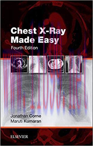 (PDF)Chest X-Ray Made Easy E-Book 4th Edition