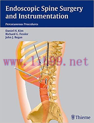 [PDF]Endoscopic Spine Surgery and Instrumentation