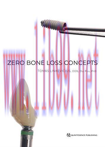 (PDF)Zero Bone Loss Concepts