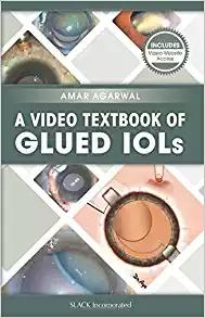 A Video Textbook of Glued IOLs