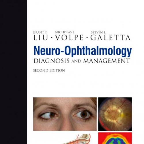 Neuro-Ophthalmology Diagnosis and Management 2