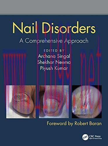 [FOX-Ebook]Nail Disorders: A Comprehensive Approach
