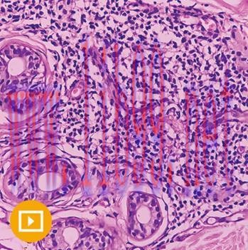 [AME]Dermatopathology 2023 (Videos)