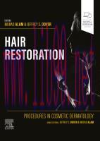 [PDF]Procedures in Cosmetic Dermatology: Hair Restoration
