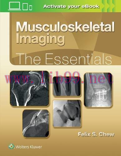 [AME]Musculoskeletal Imaging: The Essentials (ePUB)