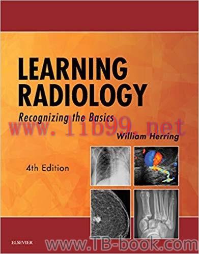 Learning Radiology: Recognizing the Basics 4th Edition by William Herring