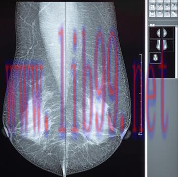 [AME]Comprehensive Review of Breast Imaging 2022 (CME VIDEOS)