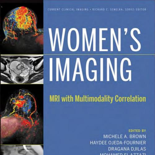 Women’s Imaging_ MRI with Multimodality Correlation - Michele A. Brown, Haydee Ojeda-Fournier, ...
