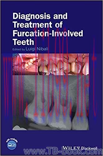 Diagnosis and Treatment of Furcation-Involved Teeth 1st Edition by Luigi Nibali