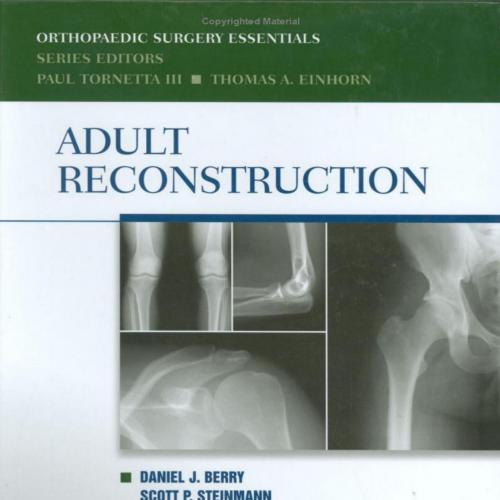 Orthopaedic Surgery Essentials Series Adult Reconstruction