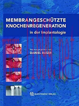 [AME]Membrangeschützte Knochenregeneration in der Implantologie (German Edition) (EPUB)