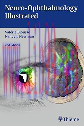 [AME]Neuro-Ophthalmology Illustrated, 2nd Edition (EPUB)