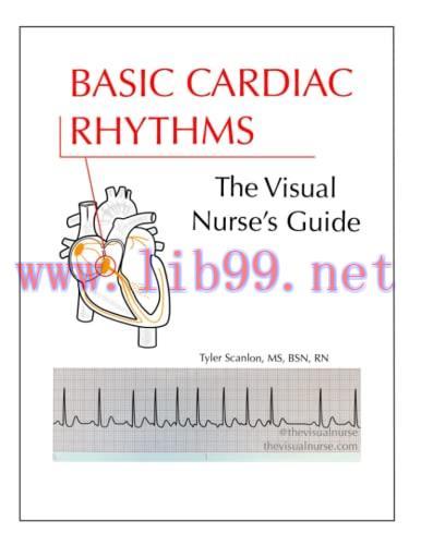 [AME]Basic Cardiac Rhythms: The Visual Nurse’s Guide (The Visual Nurse’s Basic ECG Series) (Azw...