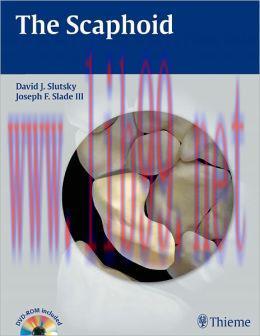 [AME]The Scaphoid