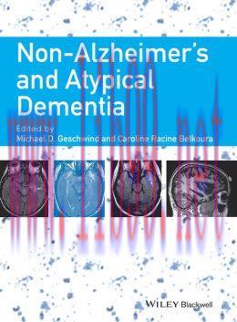 [AME]Non-Alzheimer’s and Atypical Dementia