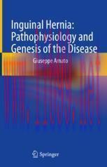 [PDF] Inguinal Hernia: Pathophysiology and Genesis of the Disease