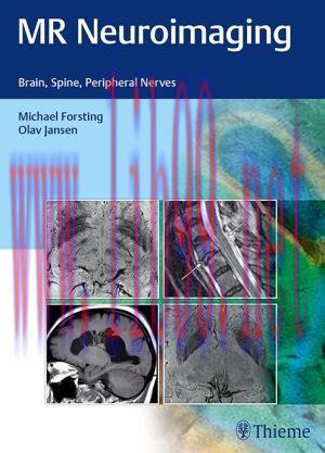 [AME]MR Neuroimaging: Brain, Spine, and Peripheral Nerves (PDF)