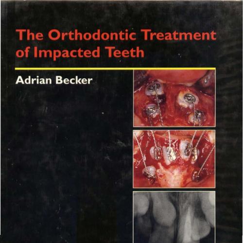 Orthodontic Treatment of Impacted Teeth, The