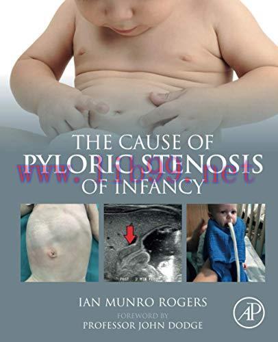 [AME]The Cause of Pyloric Stenosis of Infancy (Original PDF)