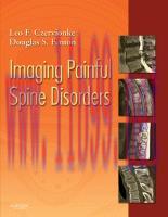 [PDF]Imaging Painful Spine Disorders