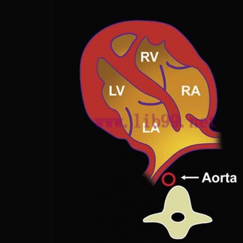 [AME]MRIOnline Imaging Mastery Series: Fetal Heart and Great Vessel Evaluation 2021 (CME VIDEOS...
