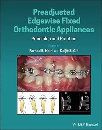 [AME]Preadjusted Edgewise Fixed Orthodontic Appliances: Principles and Practice (EPUB)