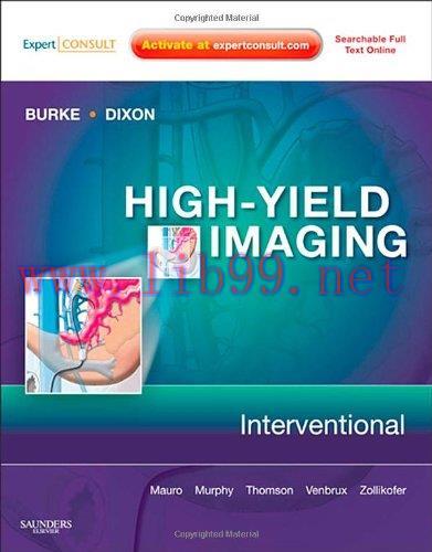 [AME]High-Yield Imaging: Interventional: Expert Consult – Online and Print, 1e (HIGH YIELD in R...