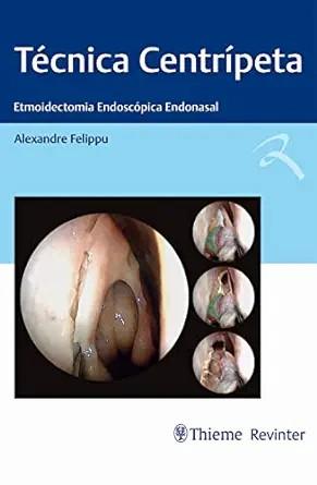 [AME]Técnica Centrípeta: Etmoidectomia Endoscópica Endonasal (Portuguese Edition) (EPUB)