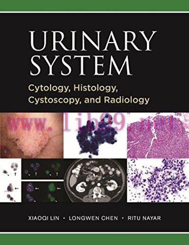 [PDF]Urinary System Cytology, Histology, Cystoscopy, and Radiology PDF+EPUB