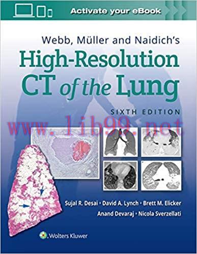 [Html]Webb, Müller and Naidich’s High-Resolution CT of the Lung 6th edition