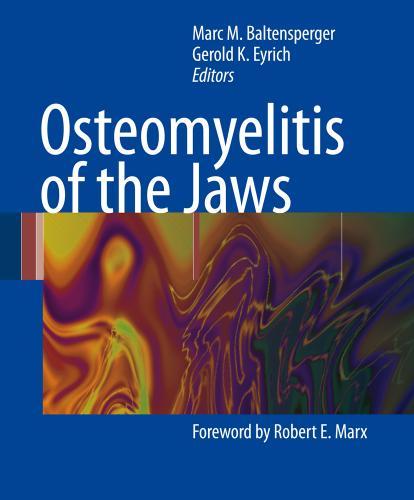 Osteomyelitis of the Jaws