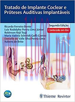 [AME]Tratado de Implante Coclear e Próteses Auditivas Implantáveis, 2nd Edition (EPUB)