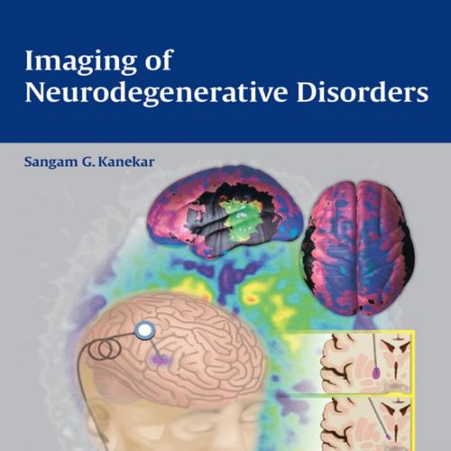 Thieme_ Imaging of Neurodegenerative Disorders