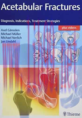[AME]Acetabular Fractures: Diagnosis, Indications, Treatment Strategies (PDF)