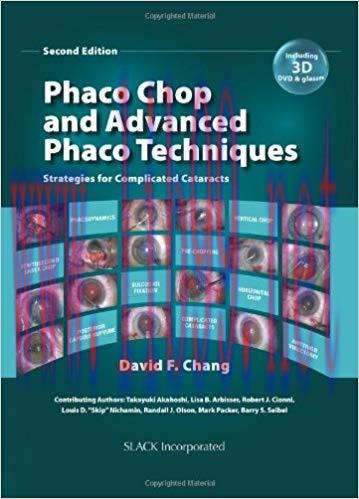[PDF]Phaco Chop and Advanced Phaco Techniques, 2nd Edition