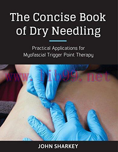 [AME]The Concise Book of Dry Needling: A Practitioner's Guide to Myofascial Trigger Point Appli...