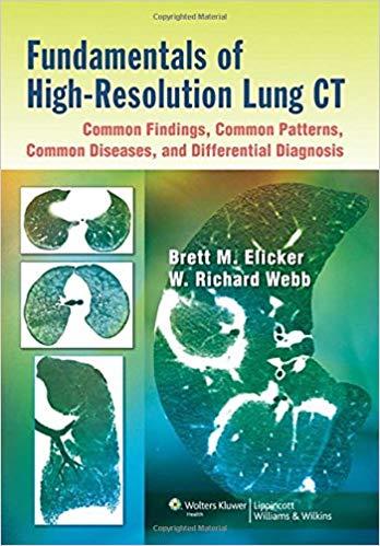 Fundamentals of High-Resolution Lung CT+CHM版