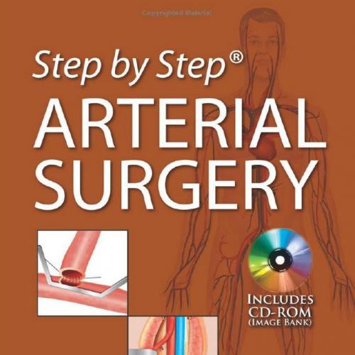 Step by Step Arterial Surgery