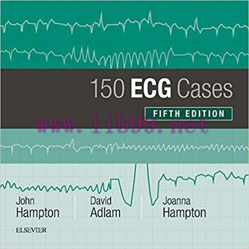 (PDF)150 ECG Cases 5th Edition