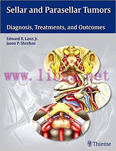 [PDF]Sellar and Parasellar Tumors
