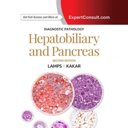 Diagnostic Pathology_ Hepatobiliary and Pancreas E-Book 2th