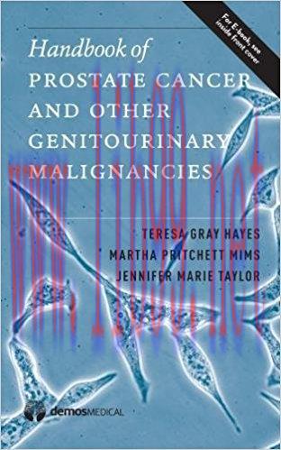 [AME]Handbook of Prostate Cancer and Other Genitourinary Malignancies (PDF)