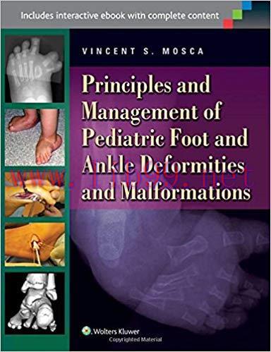 [PDF]Principles and Management of Pediatric Foot and Ankle Deformitie