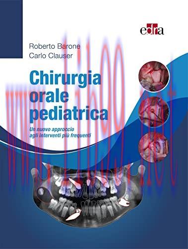 [AME]Chirurgia orale pediatrica: Un nuovo approccio agli interventi più frequenti (Italian Edit...