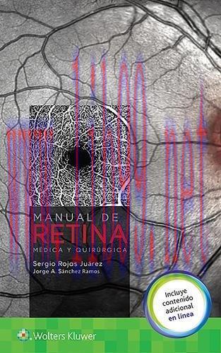 [AME]Manual de retina médica y quirúrgica (Spanish Edition) (Original PDF)